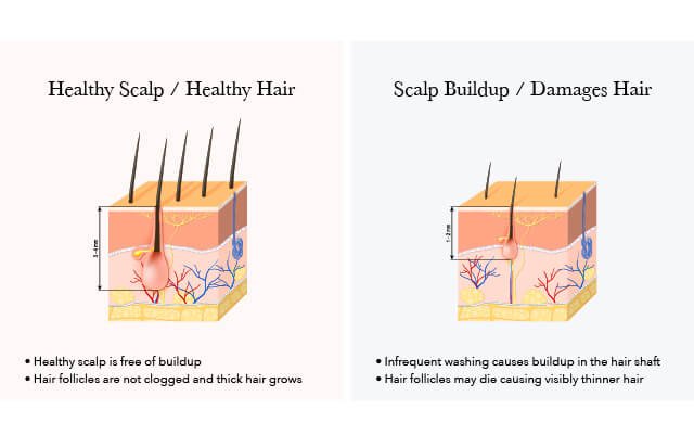 scalp buildup