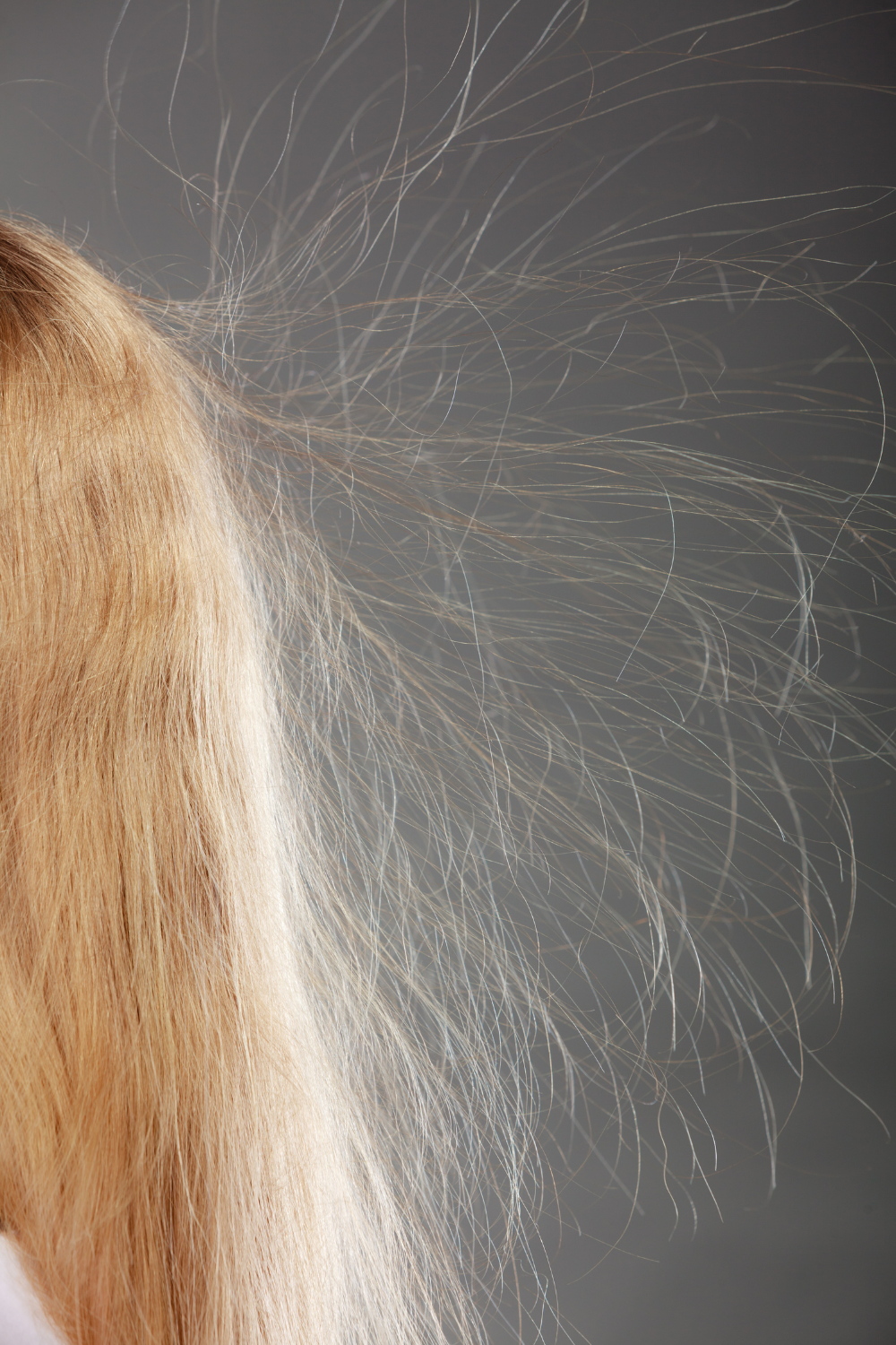 static hair in winter