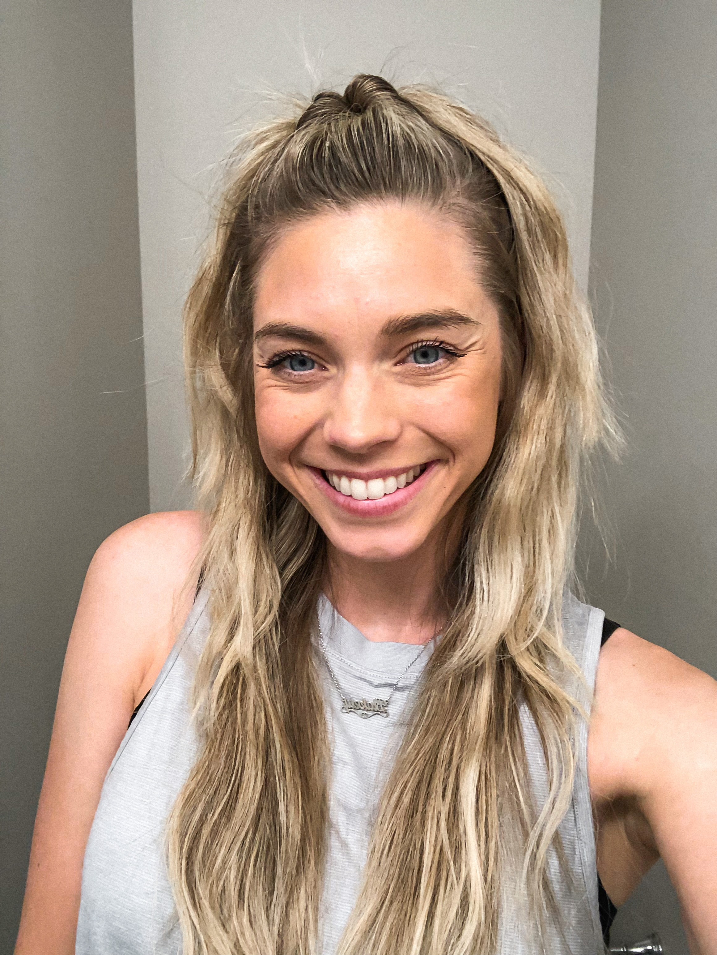 healthy scalp