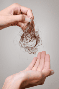 postpartum hair loss